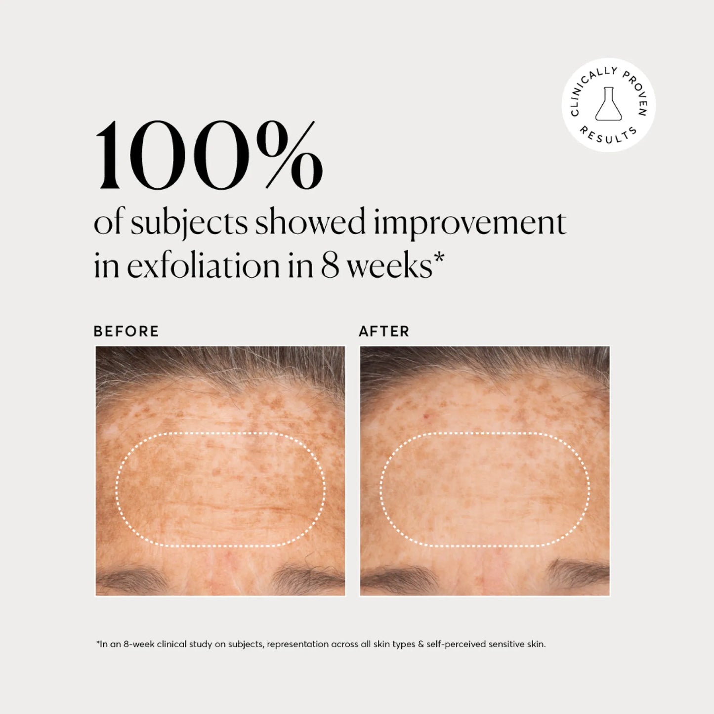bha-liquid-exfoliant-2-n2 NATR-10027-Alt-Images-BHA-Liquid-Exfoliant-2_-03.webp