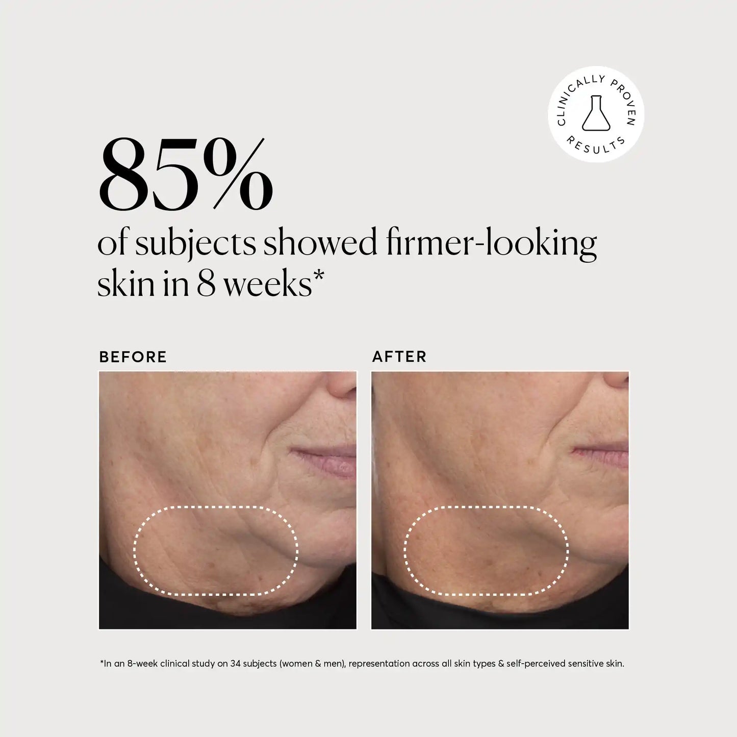 retinol-complex-serum-m0 NATR-10034-Alt-Images-Retinol-Complex-Serum-04.webp